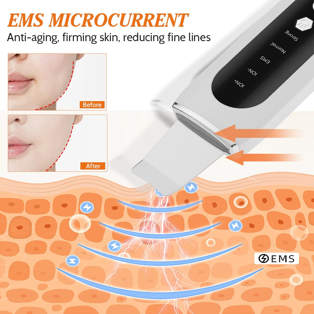 Ultrasonic Face Skin Scrubber