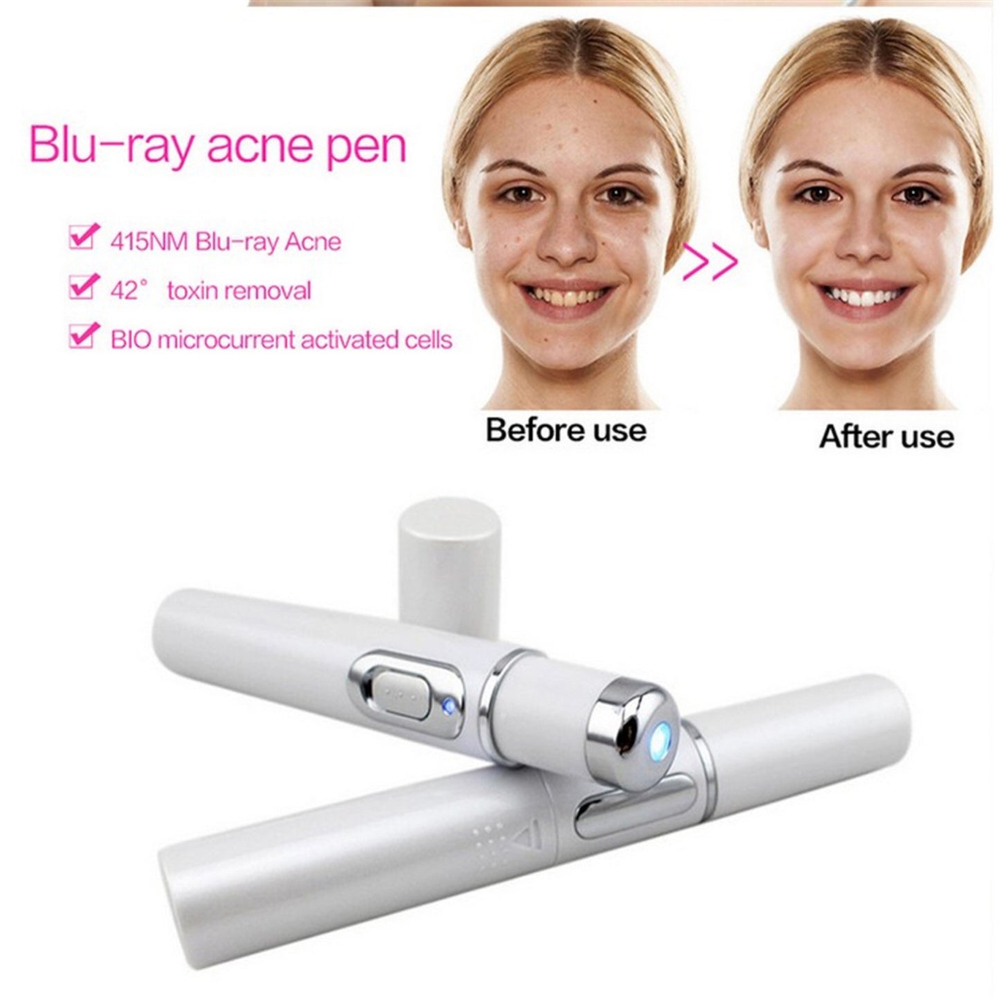 Blue Light Therapy Acne Laser Pen